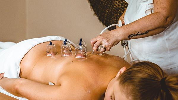 schröpfgläser für massage befinden sich auf dem Rücken von einer Frau