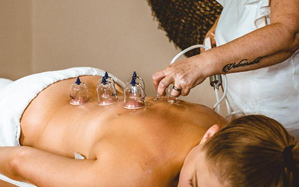 schröpfgläser für massage befinden sich auf dem Rücken von einer Frau